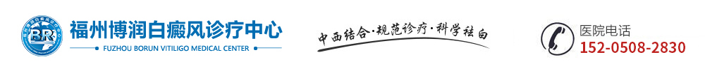 福州专门治疗白癜风的医院